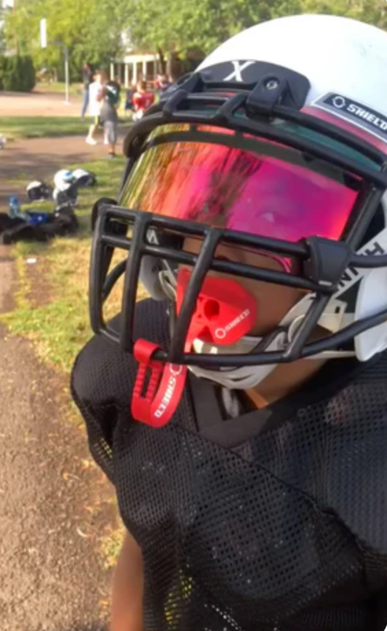 5 Features on How to Choose the Best Football Mouthguard for Performance